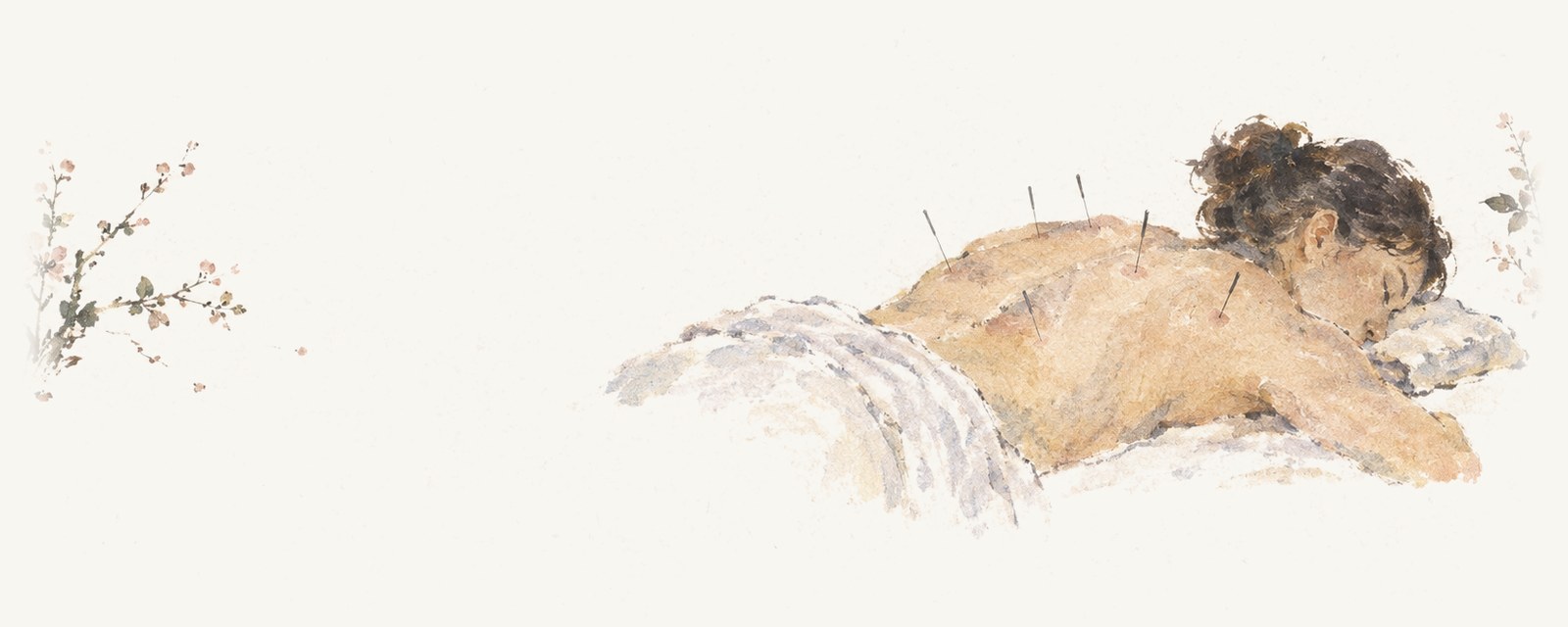 Watercolour of a woman lying face down on a treatment table, resting on a pillow, with fine acupuncture needles standing in her upper back.