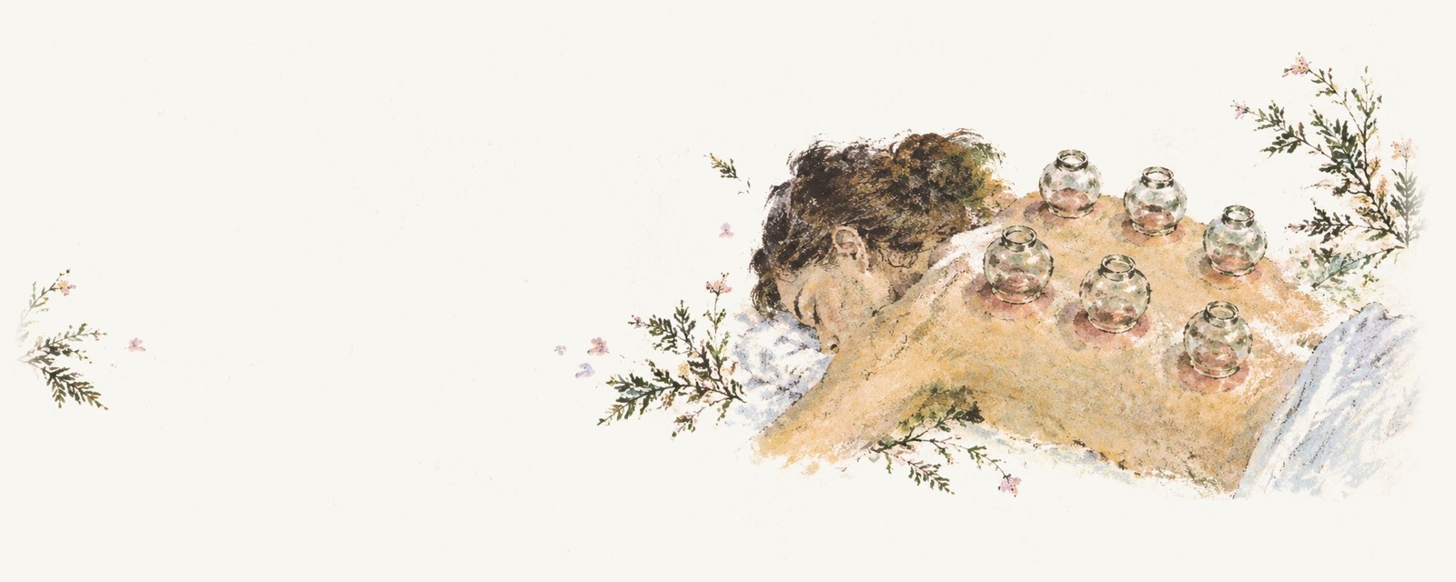 Watercolour of a woman lying face down with six glass cups set across her upper back, each leaving a soft pink mark on the skin.