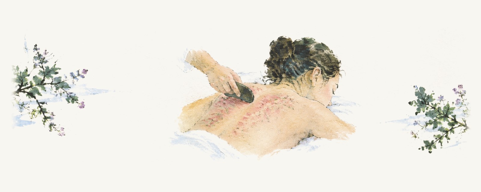Watercolour of a practitioner&rsquo;s hand drawing a dark stone gua sha tool across a woman&rsquo;s upper back as she lies face down, with red sha showing along the strokes.